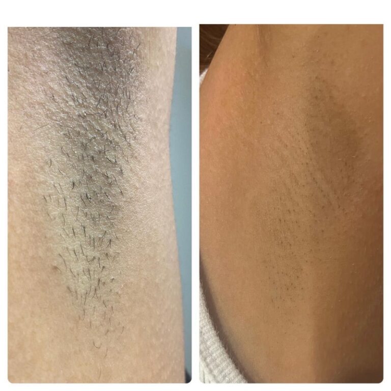 tourmaline skin care & laser hair removal service (59) tomball, texas